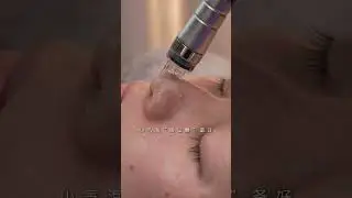 This young lady just returned from a business trip to Hong Kong, and her skin is dry and irritated