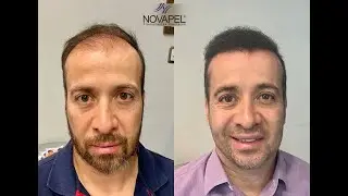 Testimonio Novapel