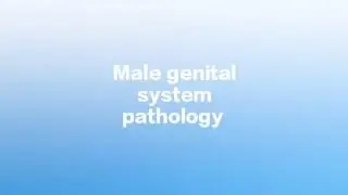 Testicular tumor part 3 #mbbs #step1prep 