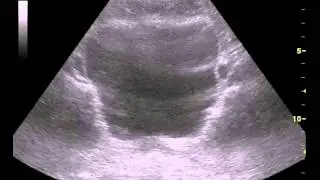 Electrical Muscle Stimulation of the Pelvic Floor Muscles using INNOVO&reg;