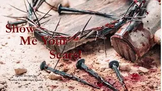 Show Me Your Scars | John 20:19-29
