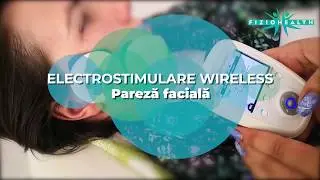 Pareza faciala   electrostimulare wireless