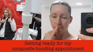 Part 1: Getting ready for my composite bonding initial appointment!