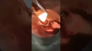 Part 51 welding TIG hard metal fusion #experiment #hardmetal #stickwelding #fusion