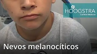 Nevos melanoc&iacute;ticos - L&aacute;ser Helios (16046)