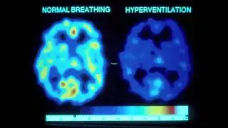 Infographic on the Human Brain