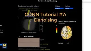 CONN Tutorial #7: Denoising
