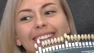 Отбеливание зубов - безопасная и безвредная процедура в сети студий белоснежной улыбки Smile Bar