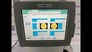 Visionix L- 80 wave  - 4 в 1 в офтальмологии!