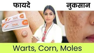 Thuja Ointment Cream Uses & Side effects | Thuja cream for moles removal, warts remover ointment