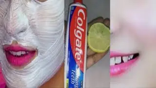 Colgate toothpaste for face whitening ll Colgate lemon face pack 🤗 @pujabhuwanvlog1296 @DiyaNag