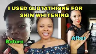 I Used Glutathione pills for skin whitening,skin lightening and hyperpigmentation