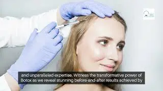 Revealed: Botox Clinic in Dallas, TX Everyone's Talking About!