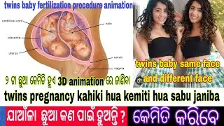twins pregnancy in odia || twins baby kemiti hua || twins baby in odia || 2ta chua kemiti hua