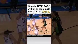 😂 Dugalic HIT IN FACE w/ ball by teammate, then scores | UCLA college basketball #shorts #short