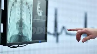 Hand pointing at medical x-ray image on screen, analyzing spine for diagnosis