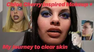 Alexandra French x Chloe Cherry Makeup Tutorial ft. My Accutane Journey