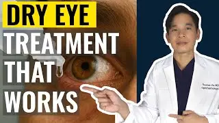 Dry Eye Treatments My Patients LOVE - Surgeon Approved for Cataract Surgery