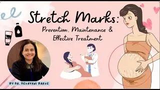 Stretch Marks: Causes, Treatment & Myths | Dr. Devayani Barve (In Marathi)
