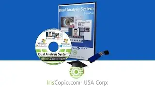 Dual Analysis System (DAS) :: Tutorial :: Video 8 :: An&aacute;lisis del Iris