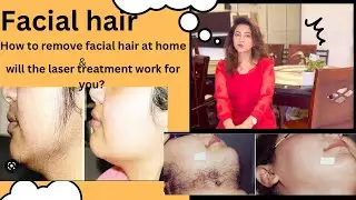Facial hair reasons, how to remove them easily at home, laser treatments