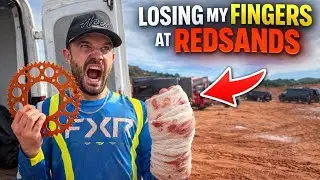 LOSING MY FINGERS AT REDSANDS