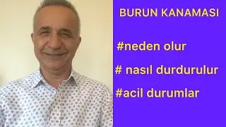 Çocuklarda Burun kanaması neden olur?Nasıl durdurulur?#burunkanaması#kanama#burun