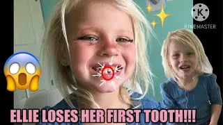 ELLIE LOSES HER FIRST TOOTH!!