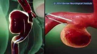 Clipping vs. Coiling