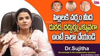 పిల్లలకి చర్మం మీద దురద, దదుర్లు ఉంటే ? Urticaria in Children - Symptoms & Treatment | IRA Health