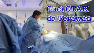 Tindakan Cuci Otak dr Terawan ~ Digital Subtraction Angiography