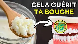 Avez-vous des probl&egrave;mes de dents et de gencives ? Solution n&deg; 1 pour l'hygi&egrave;ne buccale.