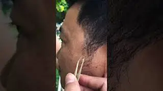 Pulling gray hair near sideburns for Mr. Hieu #shorts #shortvideo #short