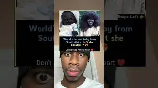 World&rsquo;s Darkest Baby From South Africa!