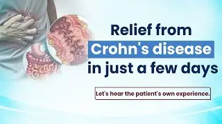 Crohn&rsquo;s Disease Treatment | Fast Recovery Journey with Modern Homeopathy Treatment #modernhomeopathy