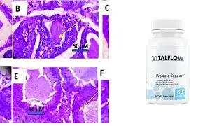 Vital Flow Review - Vitalflow Prostate Supplement ingredients, Side Effects & Discounted Price