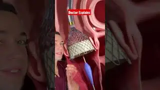 Life Saving Treatment - Valve for Aortic Stenosis - Doctor Reacts