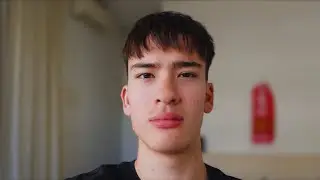 If You Have Acne, Watch This