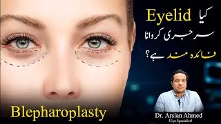 Blepharoplasty (Eyelid Surgery) Procedure Explained Urdu/Hindi | Best Eye Specialist in Lahore