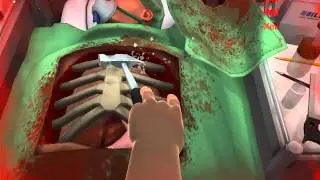 transplantede corazon muchos Fails - By;Draness