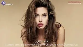 Autosoma GYNAE ArabicSUBS