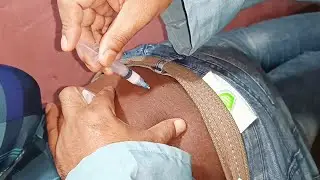 Buttock injection Tutorial. Triamcinolone im injection Tutorial 25 Ep 132 Anik health tips 