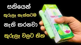කුරුලෑ වලට බය වුන කාලේ ඉවරයි🙌 Janet Ayurveda Pimples Out Skin Cleaner Roller Pen | Yuwathi Tips