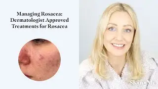 Managing Rosacea: Dermatologist Approved Treatments