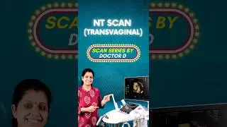 NT Scan (Transvaginal) at 12 weeks #shorts #pregnancyultrasound #ntscan #3dscan