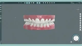 Universal Numbering System in Dentistry | Variety of Dental Numbering Systems