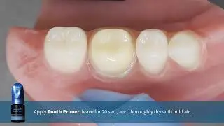 Panavia V5 Adhesive Resin Cement System (Dual Cure)
