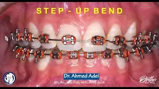 Step up bend in NiTi wire using step bend plier step by step by  dr ahmed adel orthodontics