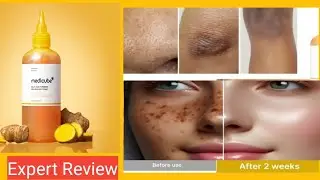 Обзор эксперта Medicube Kojic Acid Tumeric Resurfacing Toner