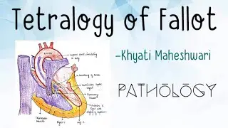 Tetralogy of Fallot |Congenital Heart Disease|TOF (Part1- Pathology)